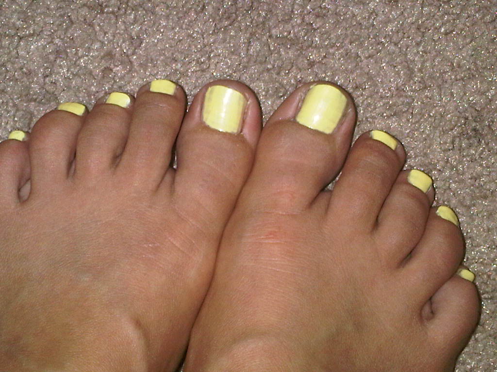 Педикюрные толстых ногтей. Желтый педикюр. Лимонный педикюр. Желтый лак на ногтях ног.