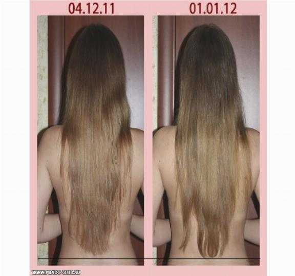 Насколько быстро растут. Никотиновая кислота для роста волос. Никотиновая кислота рост волос в месяц. Рост волос до и после. Никотиновая кислота для волос Результаты.