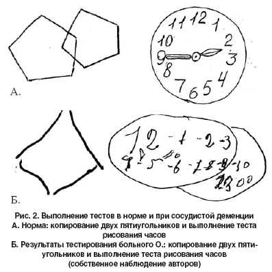 Проверка на деменцию по картинке