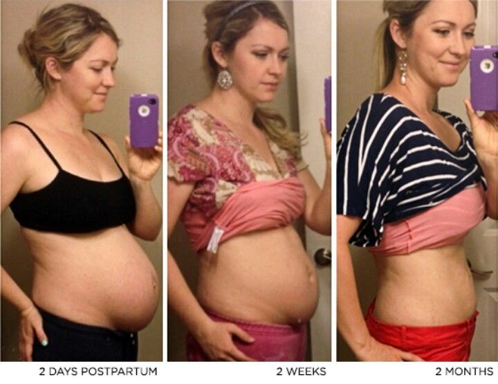 Как меняется женщина после родов фото до и после