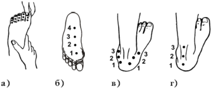 Ступня ребенка точки. Шиацу массаж точки воздействия стопы. Схема постановки пиявок на стопу. Схема шиацу точечный массаж. Точки постановки пиявок на ноги схема.