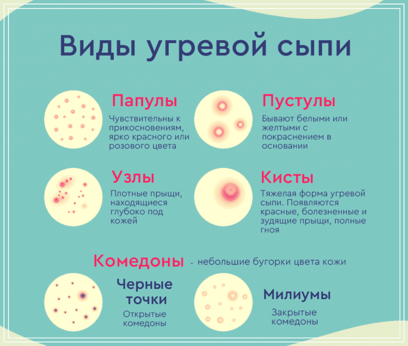 Виды сыпи у детей с картинками и название