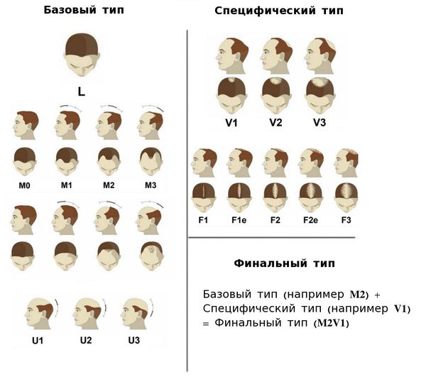 Стадии выпадения волос