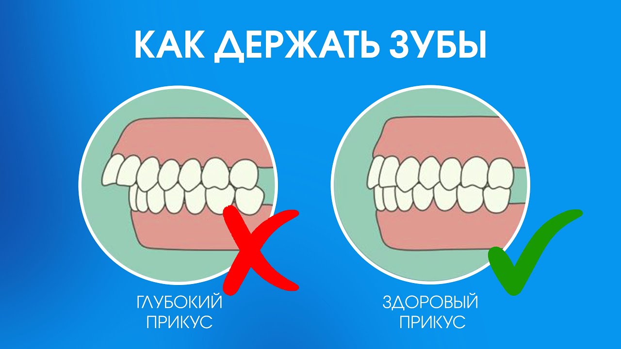 Зубы при закрытом рте. Правильное положение языка. Правильное положение зубов. Правильное положение зубов и языка. Как держать зубы.