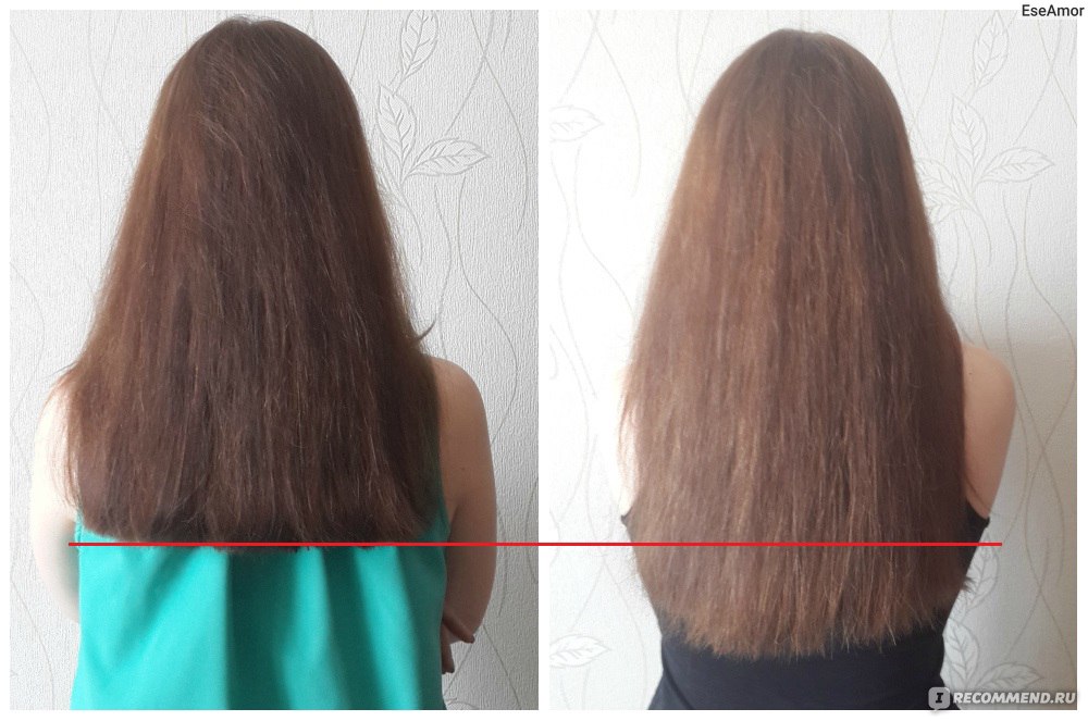 Фото как растут волосы по месяцам