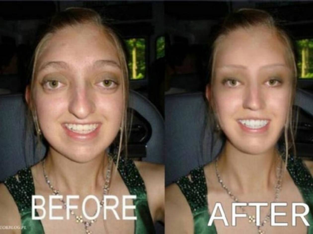 Before After Facials Tumblr