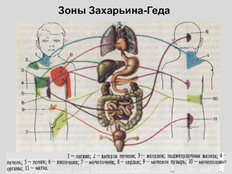 Зоны захарьина геда. Рефлексогенных зон Захарьина-Геда. Захарьина Геда атлас зоны Геда. Зоны Захарьина-Геда схема. Зоны отражения боли Захарьина _ Геда.